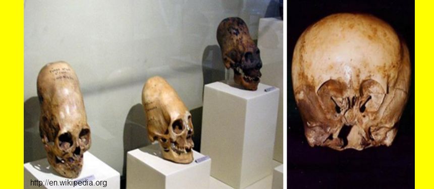 Zakázaná archeologie: RŮZNÉ PODIVNÉ LEBKY